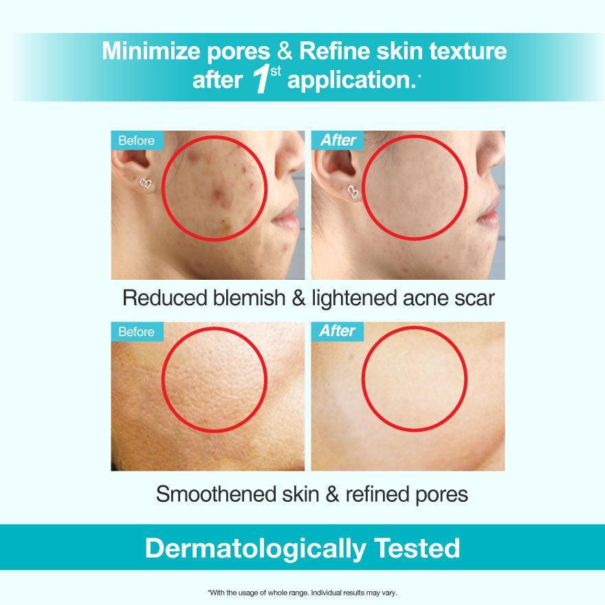 purifying cleanser 80ml - Clinelle