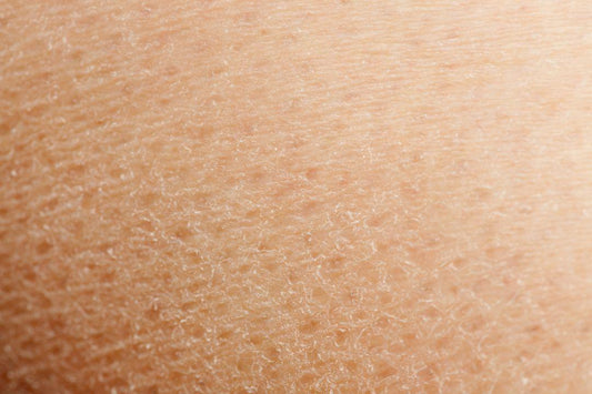 how to get rid of dry skin? - Clinelle