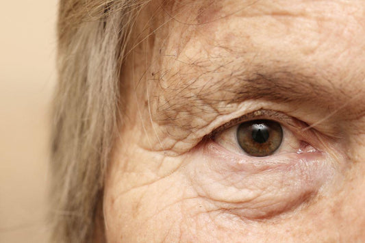learning how to take care of your delicate eye area - Clinelle