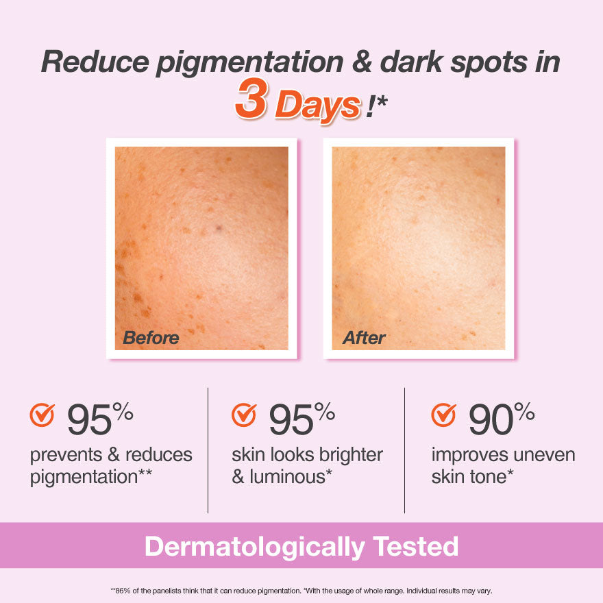 Whitenup Brightening Peeling Gel 50ml (Exp: May 2026)